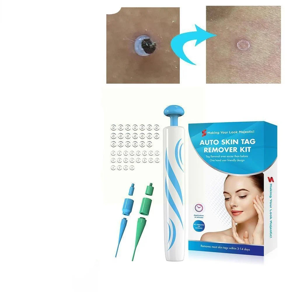 Skin Tag Remover Kit – Painless, DIY Tool With Multiple Tips, TikTok Viral Fall 2026 Fast Removal