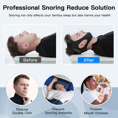 Anti Snoring Chin Strap Breathable Sleep Apnea Aid 2025