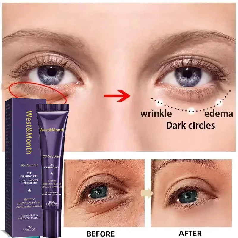 Retinol Eye Bag Removal Cream – Anti-Wrinkle Firming Dark Circle Puffiness Eye Gel Skin Care 2026