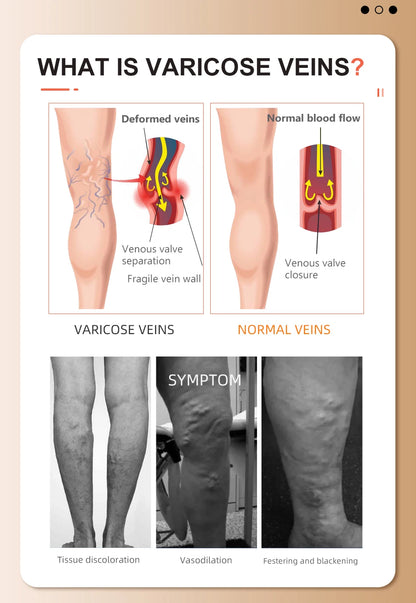 Medical Grade Compression Stockings 34–46mmHg Class 3 – Varicose Veins Support Calf Sleeve Unisex S–7XL 2026