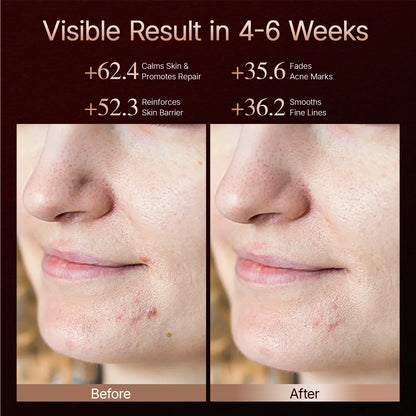LED Light Therapy Mask 4D Facial Device Anti Aging And Acne Care Fall 2026 Skincare Trend